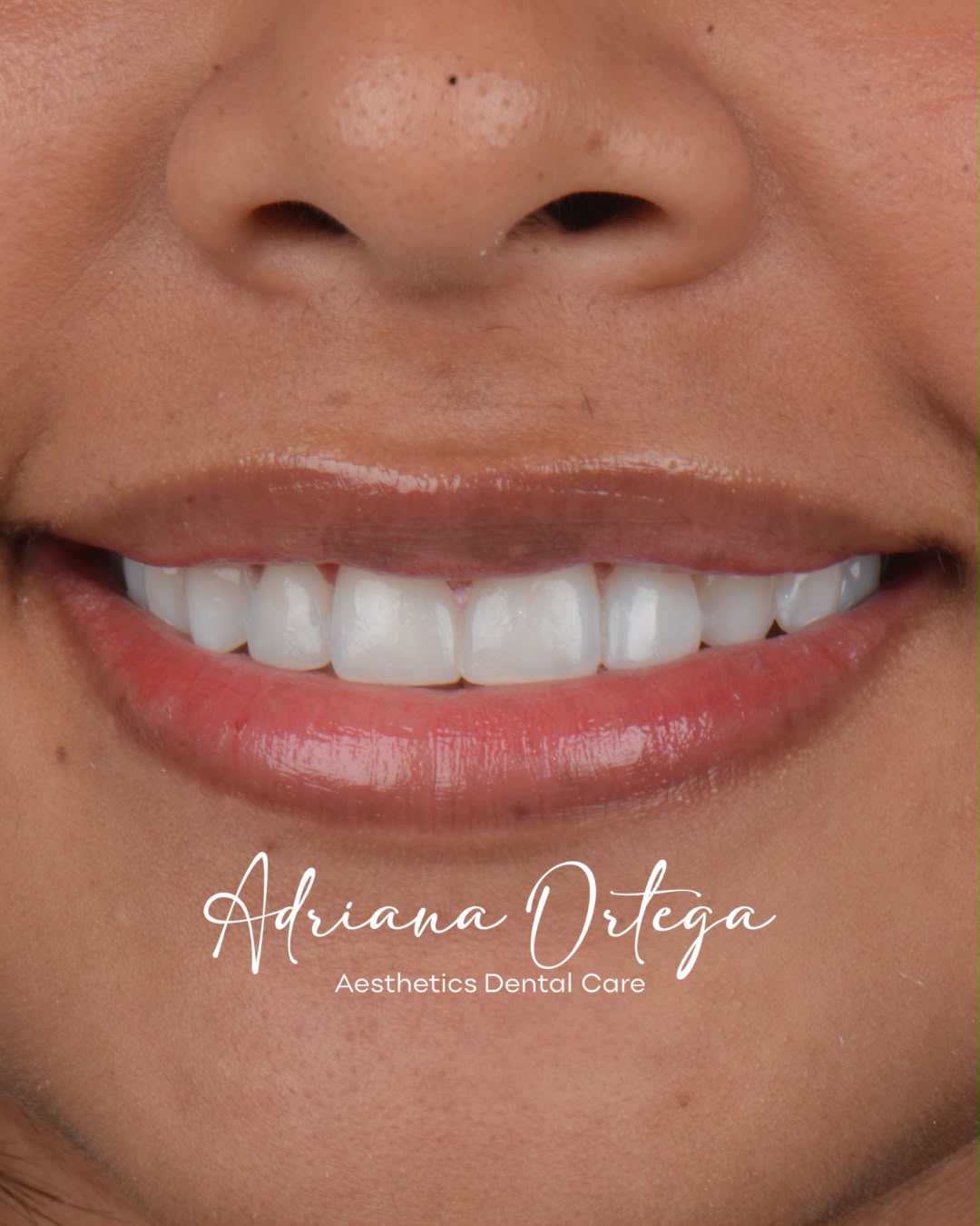 Diseño de Sonrisa